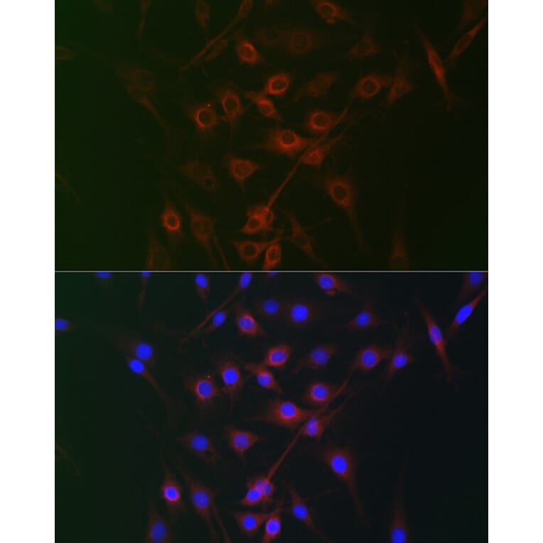 Immunofluorescence - Anti-Rag A Antibody (A15885) - Antibodies.com