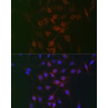 Immunofluorescence - Anti-Rag A Antibody (A15885) - Antibodies.com