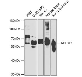 Western Blot - Anti-IRBIT Antibody (A15886) - Antibodies.com