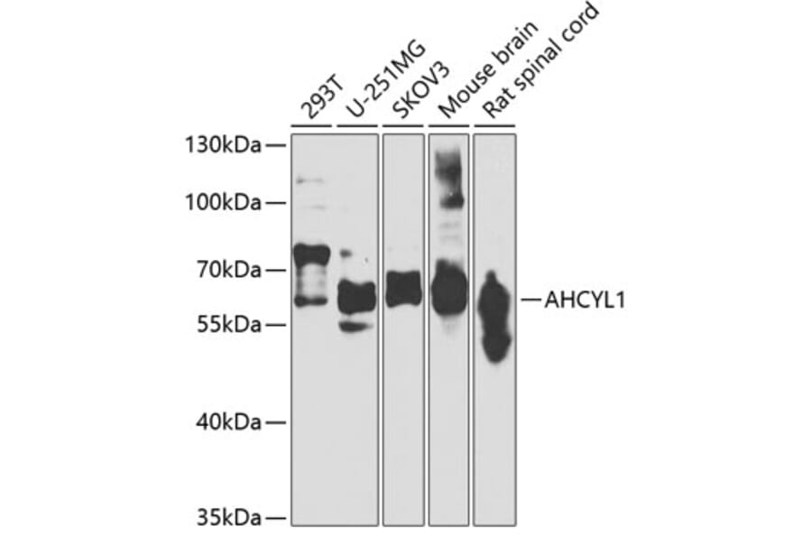 Western Blot - Anti-IRBIT Antibody (A15886) - Antibodies.com