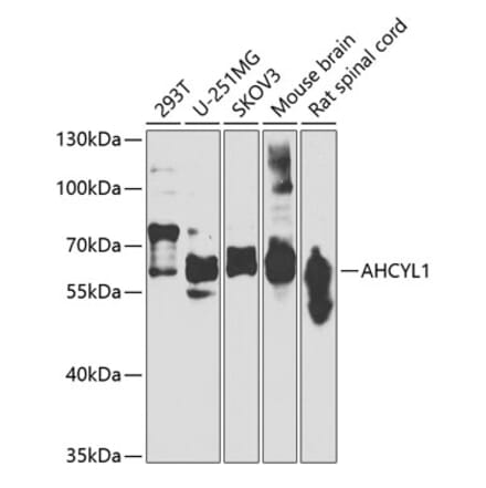 Western Blot - Anti-IRBIT Antibody (A15886) - Antibodies.com