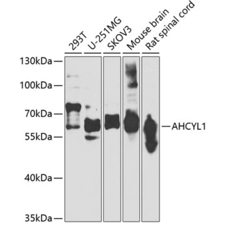Western Blot - Anti-IRBIT Antibody (A15886) - Antibodies.com