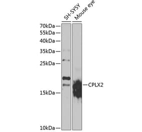 Western Blot - Anti-CPLX2 Antibody (A15887) - Antibodies.com
