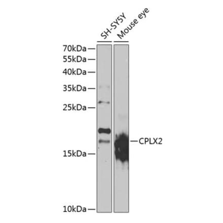 Western Blot - Anti-CPLX2 Antibody (A15887) - Antibodies.com