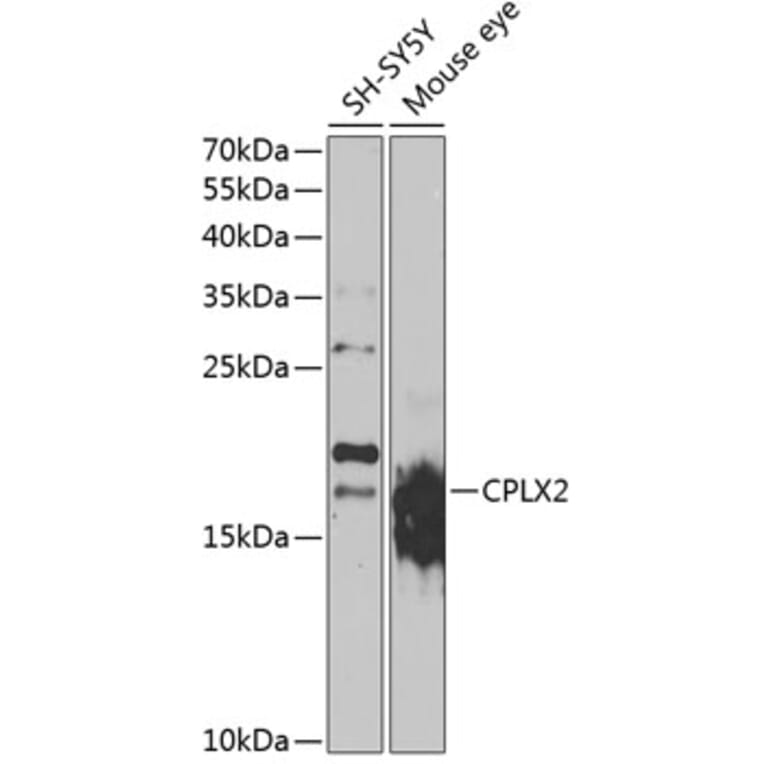 Western Blot - Anti-CPLX2 Antibody (A15887) - Antibodies.com