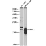 Western Blot - Anti-CPLX2 Antibody (A15887) - Antibodies.com