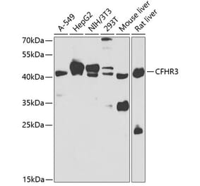 Western Blot - Anti-Complement factor H-related protein 3 Antibody (A15888) - Antibodies.com