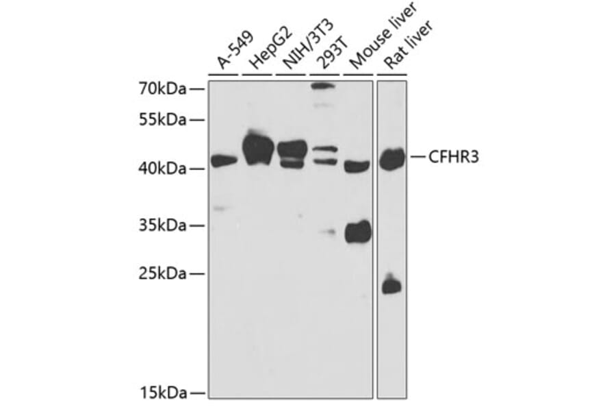 Western Blot - Anti-Complement factor H-related protein 3 Antibody (A15888) - Antibodies.com