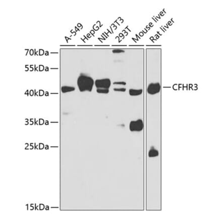 Western Blot - Anti-Complement factor H-related protein 3 Antibody (A15888) - Antibodies.com