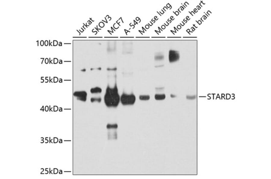 Western Blot - Anti-MLN64 Antibody (A15889) - Antibodies.com