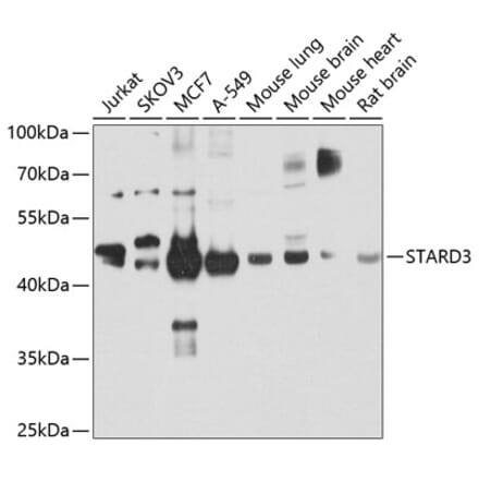 Western Blot - Anti-MLN64 Antibody (A15889) - Antibodies.com