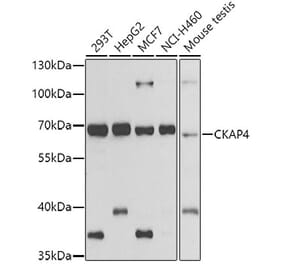 Western Blot - Anti-CKAP4 Antibody (A15890) - Antibodies.com