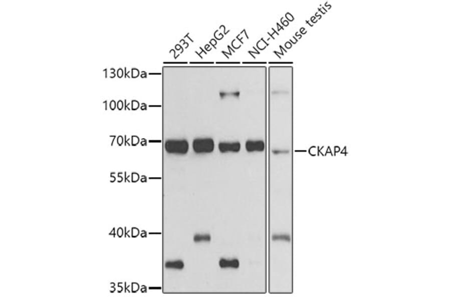 Western Blot - Anti-CKAP4 Antibody (A15890) - Antibodies.com
