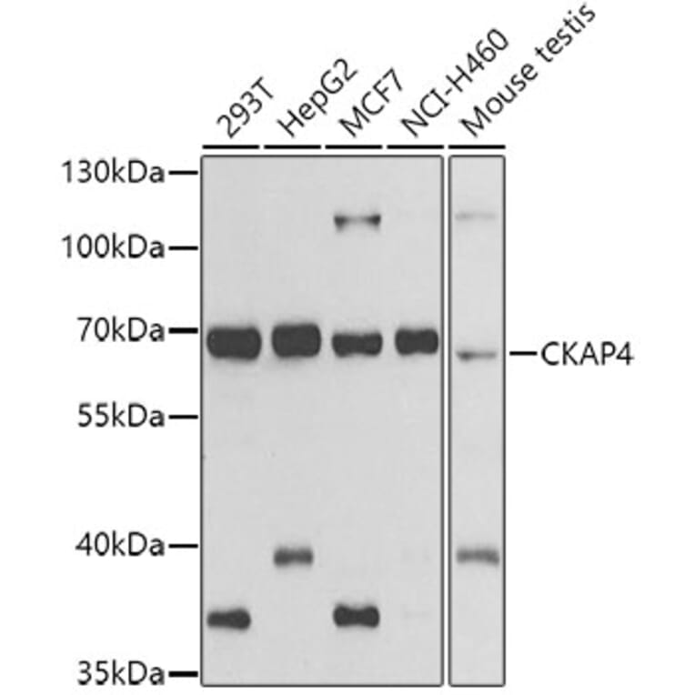 Western Blot - Anti-CKAP4 Antibody (A15890) - Antibodies.com
