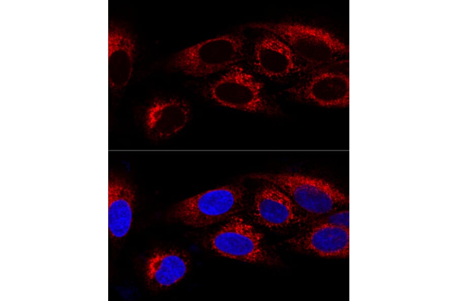 Immunofluorescence - Anti-CKAP4 Antibody (A15890) - Antibodies.com