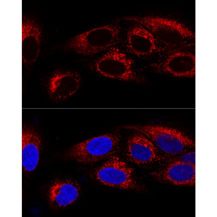 Immunofluorescence - Anti-CKAP4 Antibody (A15890) - Antibodies.com
