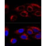 Immunofluorescence - Anti-CKAP4 Antibody (A15890) - Antibodies.com