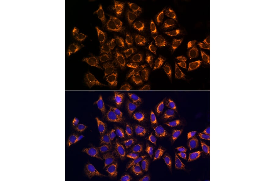 Immunofluorescence - Anti-CKAP4 Antibody (A15890) - Antibodies.com
