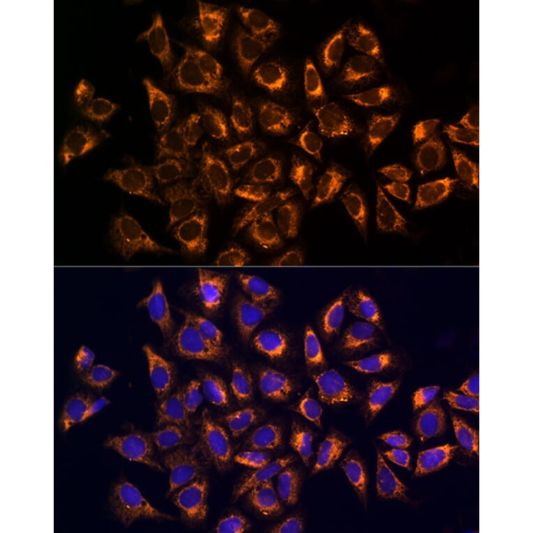 Immunofluorescence - Anti-CKAP4 Antibody (A15890) - Antibodies.com