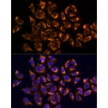 Immunofluorescence - Anti-CKAP4 Antibody (A15890) - Antibodies.com