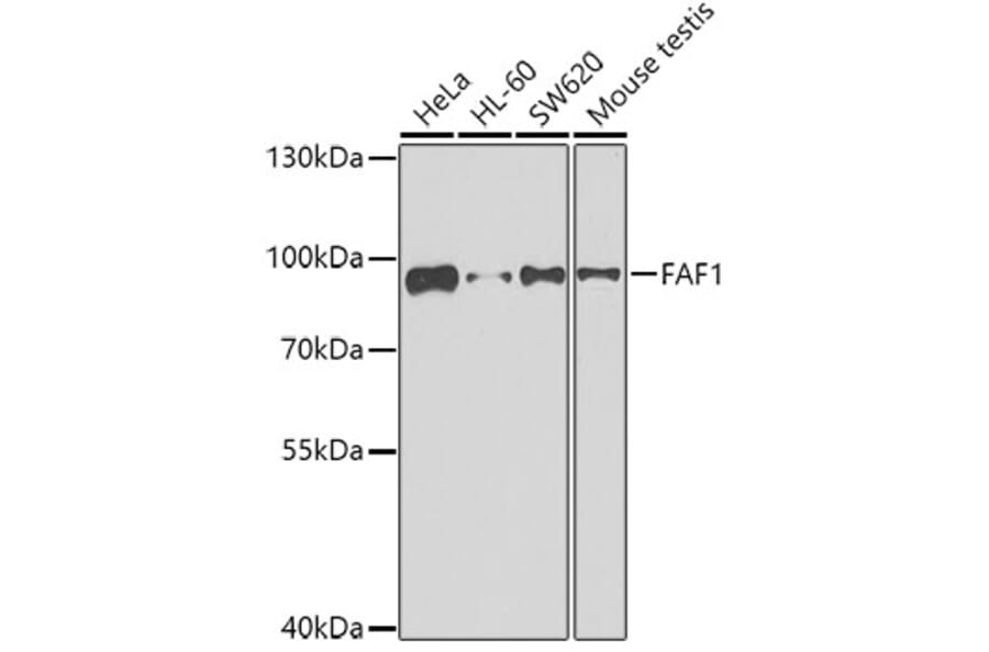 Western Blot - Anti-FAF1 Antibody (A7779) - Antibodies.com