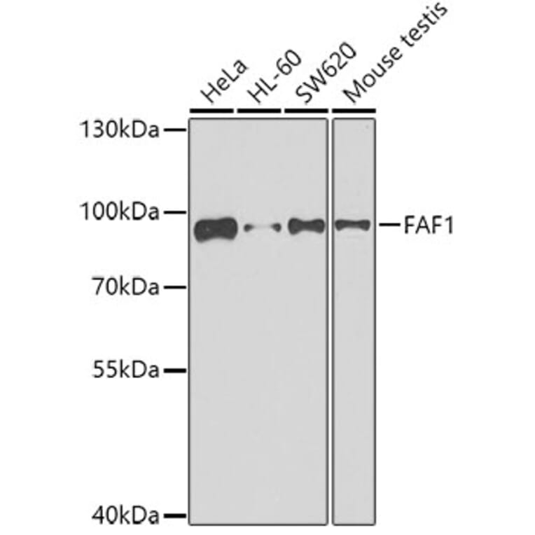 Western Blot - Anti-FAF1 Antibody (A7779) - Antibodies.com