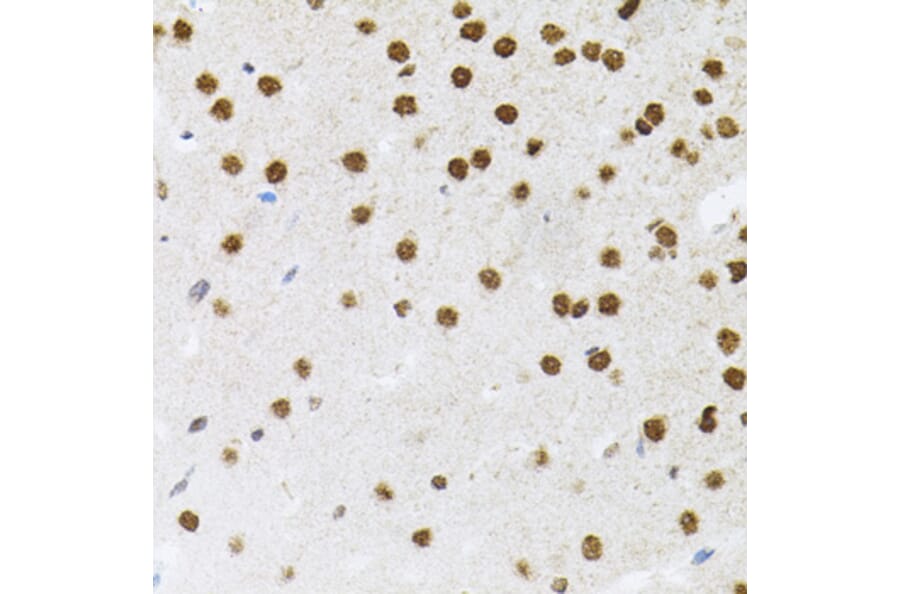 Immunohistochemistry - Anti-FAF1 Antibody (A7779) - Antibodies.com
