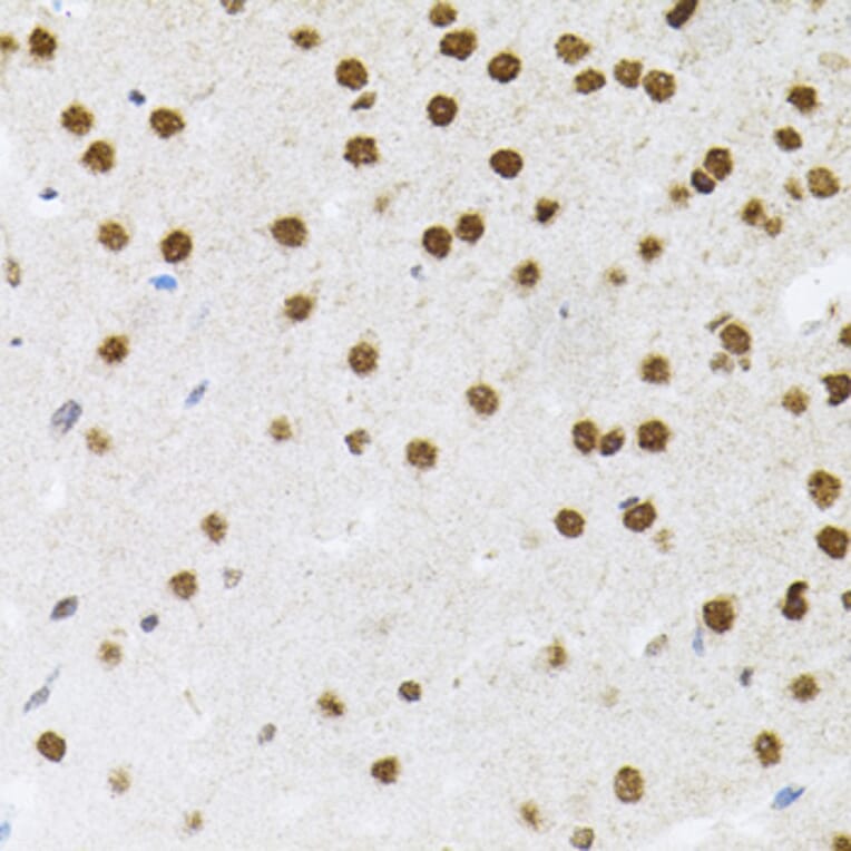 Immunohistochemistry - Anti-FAF1 Antibody (A7779) - Antibodies.com