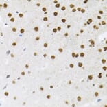 Immunohistochemistry - Anti-FAF1 Antibody (A7779) - Antibodies.com