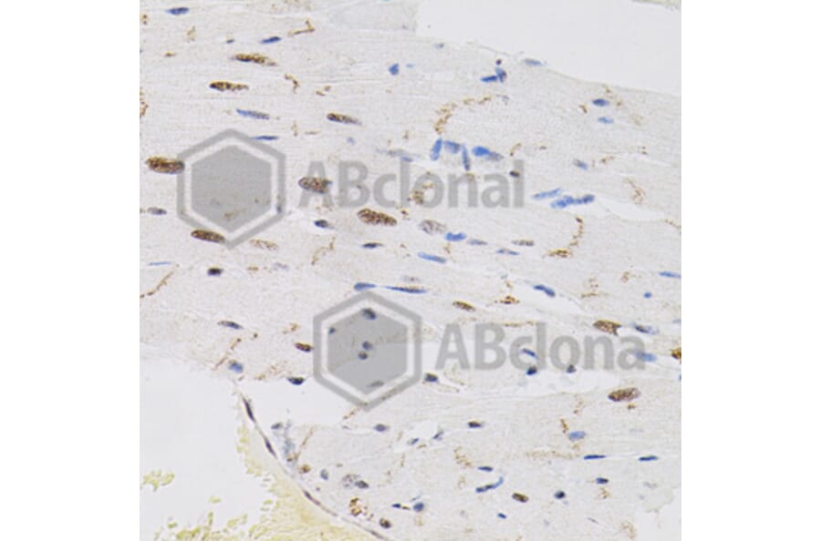 Immunohistochemistry - Anti-FAF1 Antibody (A7779) - Antibodies.com