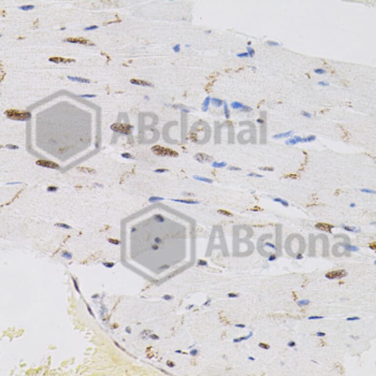 Immunohistochemistry - Anti-FAF1 Antibody (A7779) - Antibodies.com