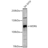 Western Blot - Anti-WDR6 Antibody (A15892) - Antibodies.com