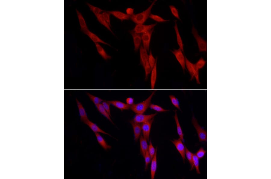 Immunofluorescence - Anti-WDR6 Antibody (A15892) - Antibodies.com