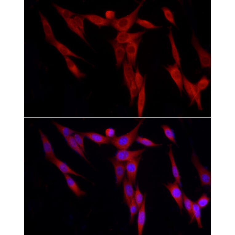Immunofluorescence - Anti-WDR6 Antibody (A15892) - Antibodies.com