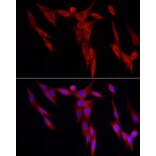 Immunofluorescence - Anti-WDR6 Antibody (A15892) - Antibodies.com