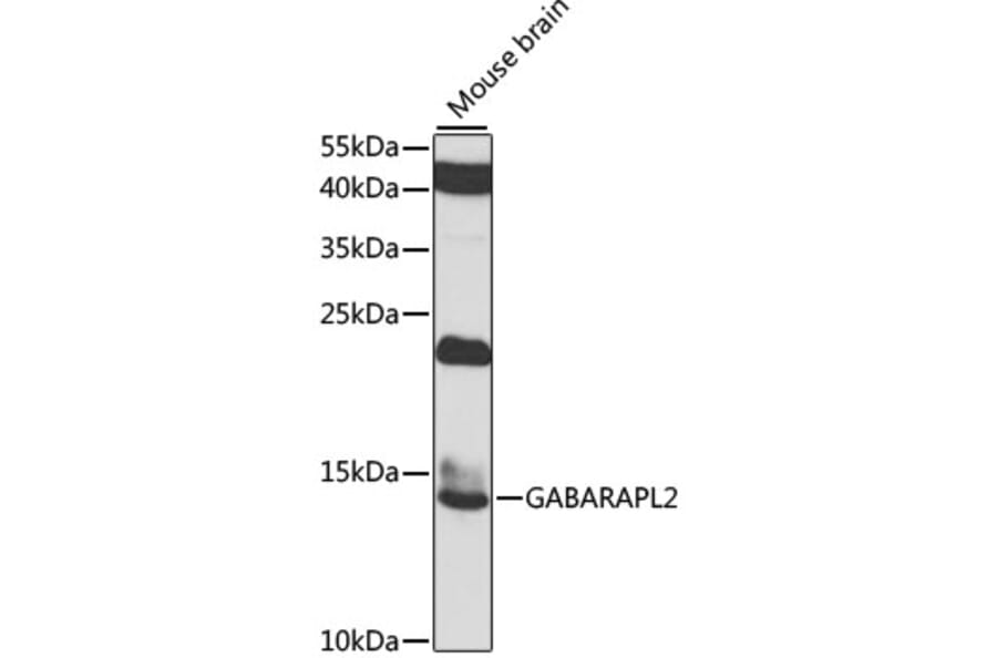 Western Blot - Anti-GABARAPL2/GATE-16 Antibody (A15893) - Antibodies.com