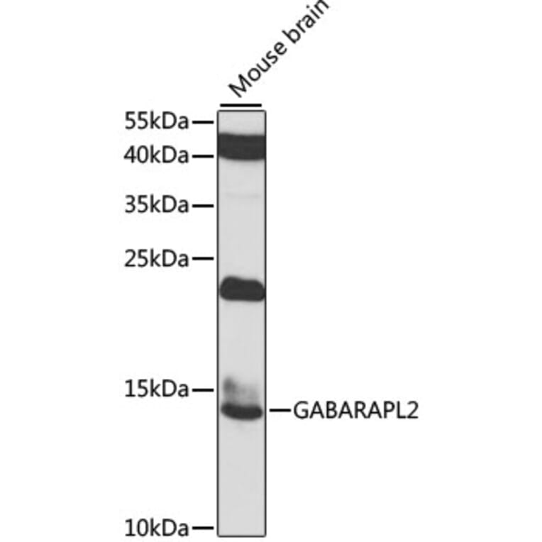 Western Blot - Anti-GABARAPL2/GATE-16 Antibody (A15893) - Antibodies.com
