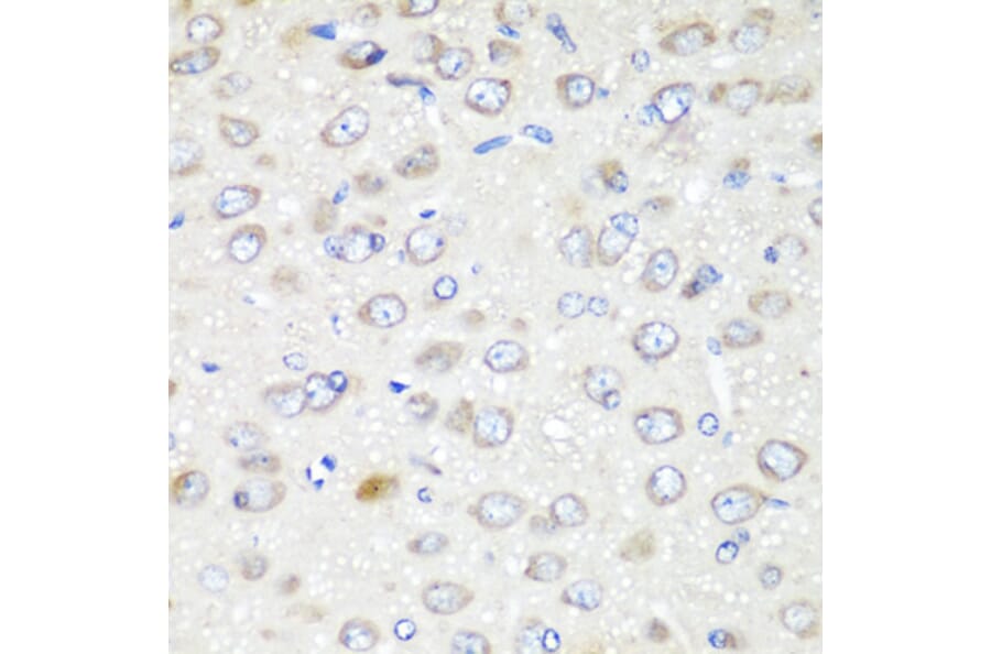 Immunohistochemistry - Anti-GABARAPL2/GATE-16 Antibody (A15893) - Antibodies.com