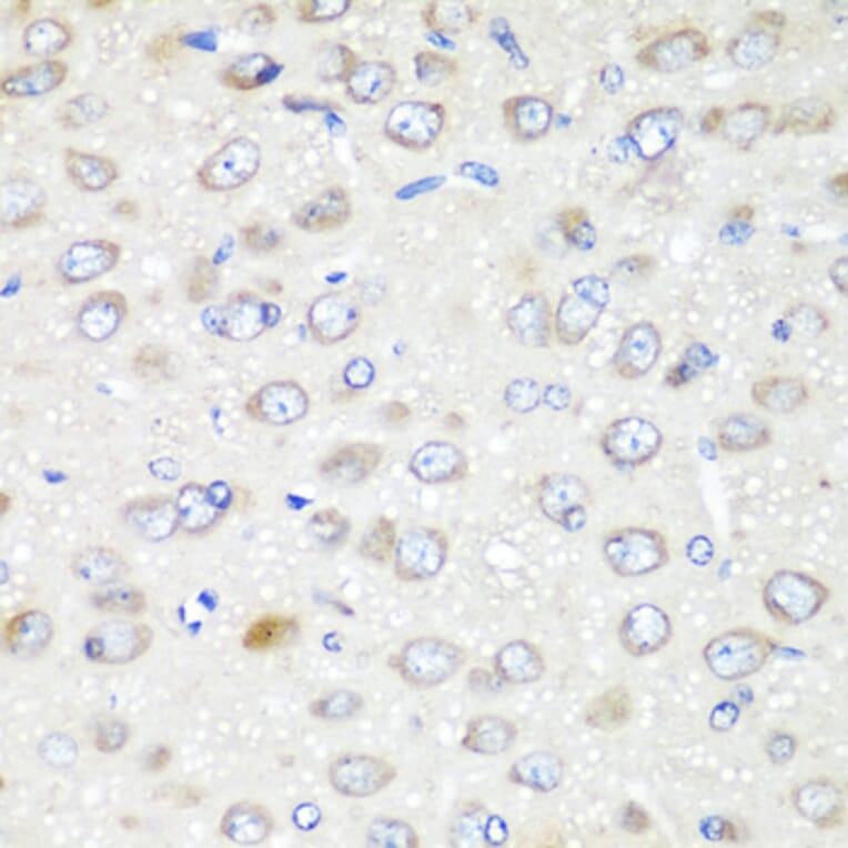 Immunohistochemistry - Anti-GABARAPL2/GATE-16 Antibody (A15893) - Antibodies.com