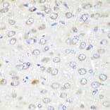 Immunohistochemistry - Anti-GABARAPL2/GATE-16 Antibody (A15893) - Antibodies.com