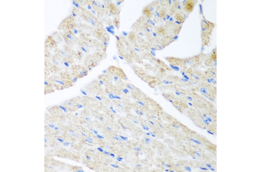 Immunohistochemistry - Anti-GABARAPL2/GATE-16 Antibody (A15893) - Antibodies.com