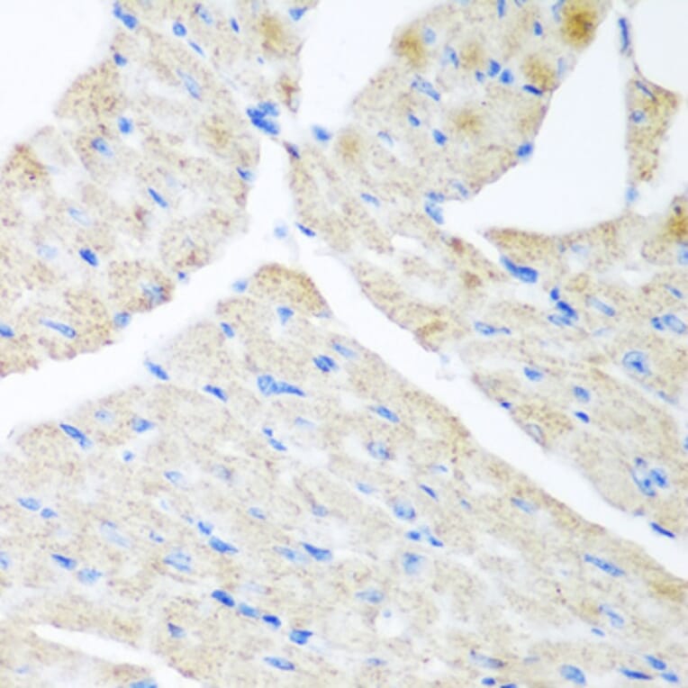 Immunohistochemistry - Anti-GABARAPL2/GATE-16 Antibody (A15893) - Antibodies.com