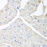Immunohistochemistry - Anti-GABARAPL2/GATE-16 Antibody (A15893) - Antibodies.com