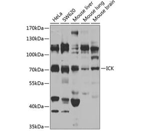 Western Blot - Anti-ICK Antibody (A15894) - Antibodies.com
