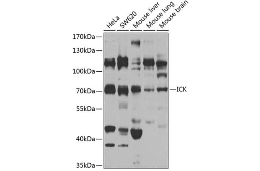 Western Blot - Anti-ICK Antibody (A15894) - Antibodies.com