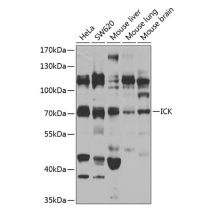 Western Blot - Anti-ICK Antibody (A15894) - Antibodies.com