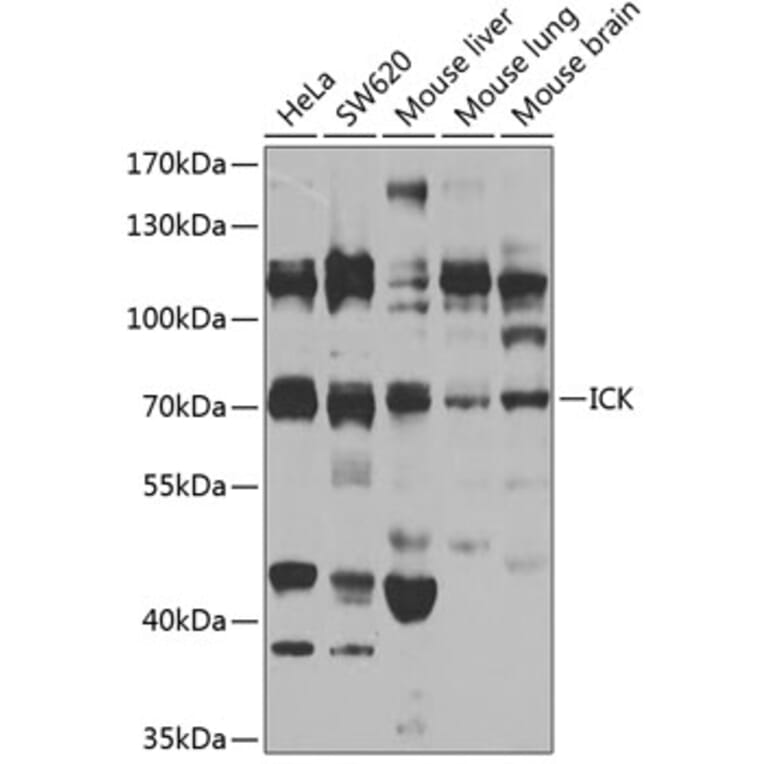 Western Blot - Anti-ICK Antibody (A15894) - Antibodies.com