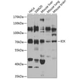 Western Blot - Anti-ICK Antibody (A15894) - Antibodies.com