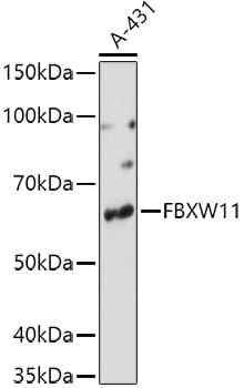 Western blot analysis of extracts of various cell lines, using Anti-FBXW11 Antibody (A7784) at 1:1,000 dilution.
Secondary antibody: Goat Anti-Rabbit IgG (H+L) (HRP) (AS014) at 1:10,000 dilution.
Lysates / proteins: 25µg per lane.
Blocking buffer: 3% non-fat dry milk in TBST.
Detection: ECL Basic Kit (RM00020).
Exposure time: 90s.
