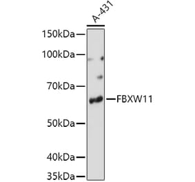 Western Blot - Anti-FBXW11 Antibody (A15895) - Antibodies.com